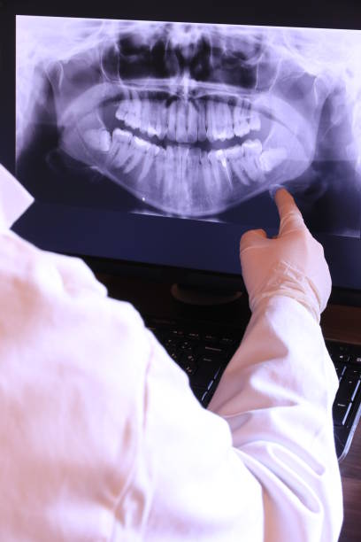 Best Emergency Gum Treatment in Linganore, MD