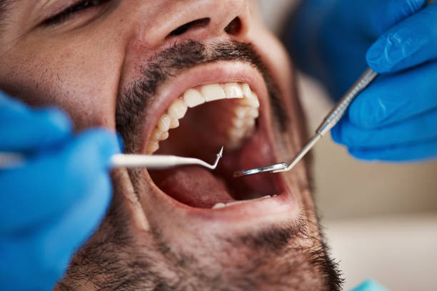Best Cosmetic Emergency Dentistry in Linganore, MD
